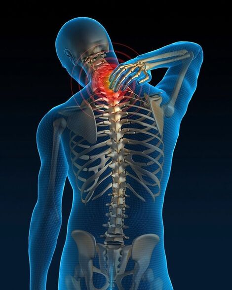 In the initial phase of cervical osteochondrosis treatment, neck pain increases